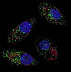 MAP1LC3B (Cleaved) Rabbit anti-Human, Mouse, Polyclonal , Abnova 400 &mu;L | Buy Online | Abnova Corporation | Fisher Scientific