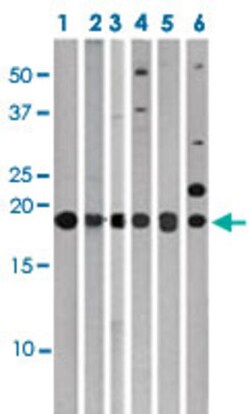 MAP1LC3C Rabbit anti-Human, Polyclonal , Abnova 400&mu;L; Unlabeled:Antibodies,