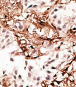 MAP1LC3C Rabbit anti-Human, Polyclonal , Abnova 400&mu;L; Unlabeled:Antibodies,