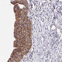 CD47 Rabbit anti-Human, Polyclonal , Abnova 100 &mu;L | Buy Online | Abnova | Fisher Scientific