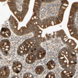 ADAM17 Rabbit anti-Human, Polyclonal , Abnova 100 &mu;L | Buy Online | Abnova Corporation | Fisher Scientific