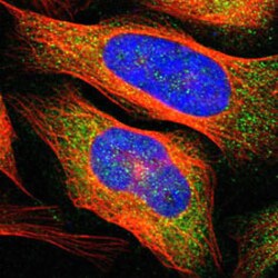 ADAM17 Rabbit anti-Human, Polyclonal , Abnova 100 &mu;L | Buy Online | Abnova Corporation | Fisher Scientific