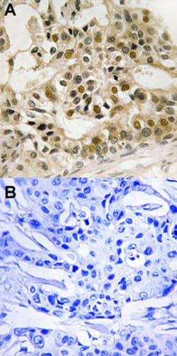 MYB (phospho S532) Rabbit anti-Human, Mouse, Polyclonal , Abnova 100&mu;L;