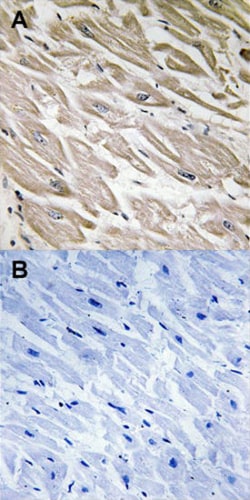 PPP1R2 (phospho S121/S122) Rabbit anti-Human, Mouse, Rat, Polyclonal ,