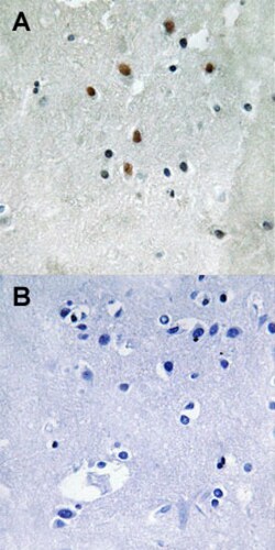 SRF (phospho S77) Rabbit anti-Human, Mouse, Polyclonal , Abnova 100 &mu;L | Buy Online | Abnova Corporation | Fisher Scientific