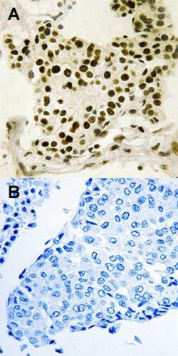 UBTF (phospho S484) Rabbit anti-Human, Mouse, Rat, Polyclonal , Abnova