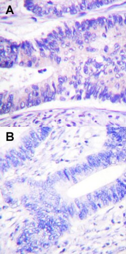 WASF1 (phospho Y125) Rabbit anti-Human, Mouse, Polyclonal , Abnova 100&mu;L;