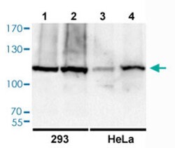RB1 (phospho S811) Rabbit anti-Human, Mouse, Rat, Polyclonal , Abnova 100&mu;L;