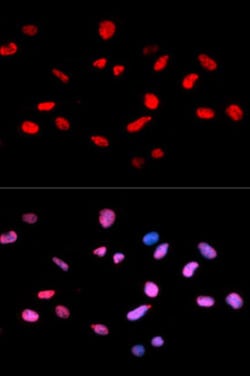 RB1 (phospho S811) Rabbit anti-Human, Mouse, Rat, Polyclonal , Abnova 100&mu;L;