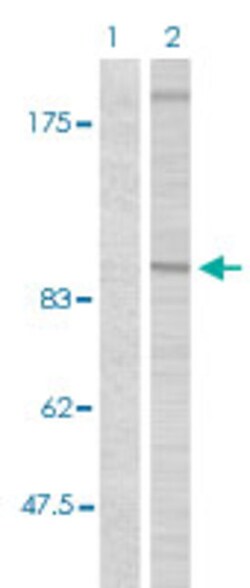 IGF1R (phospho Y1161) Rabbit anti-Human, Mouse, Rabbit, Polyclonal , Abnova