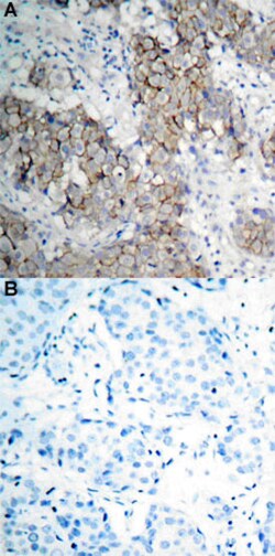 IGF1R (phospho Y1161) Rabbit anti-Human, Mouse, Rabbit, Polyclonal , Abnova