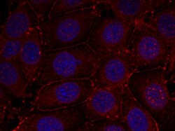 IGF1R (phospho Y1161) Rabbit anti-Human, Mouse, Rabbit, Polyclonal , Abnova