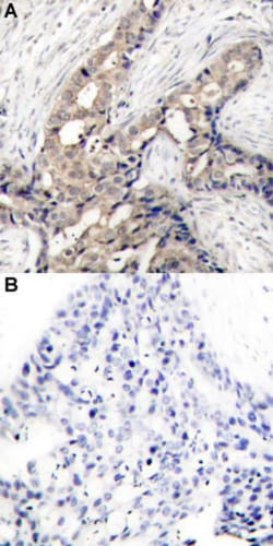 ABL1 (phospho Y412) Rabbit anti-Human, Mouse, Rabbit, Polyclonal , Abnova 100 &mu;L | Buy Online | Abnova | Fisher Scientific