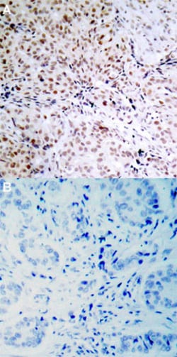 RB1 (phospho S795) Rabbit anti-Human, Polyclonal , Abnova 100&mu;L; Unlabeled:Antibodies,