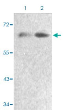 FOXO4 (phospho S197) Rabbit anti-Human, Mouse, Rabbit, Polyclonal , Abnova 100 &mu;L | Buy Online | Abnova | Fisher Scientific