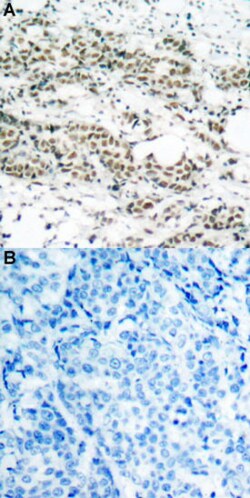 FOXO4 (phospho S197) Rabbit anti-Human, Mouse, Rabbit, Polyclonal , Abnova 100 &mu;L | Buy Online | Abnova | Fisher Scientific