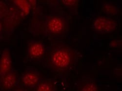 FOXO4 (phospho S197) Rabbit anti-Human, Mouse, Rabbit, Polyclonal , Abnova 100 &mu;L | Buy Online | Abnova | Fisher Scientific