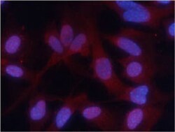PKM (phospho S37) Rabbit anti-Human, Polyclonal , Abnova 100&mu;L; Unlabeled:Antibodies,