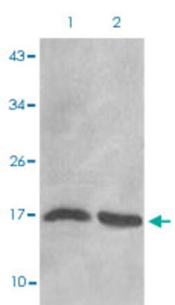 HIST1H3D (dimethyl-K27) Rabbit anti-Human, Mouse, Rabbit, Polyclonal ,