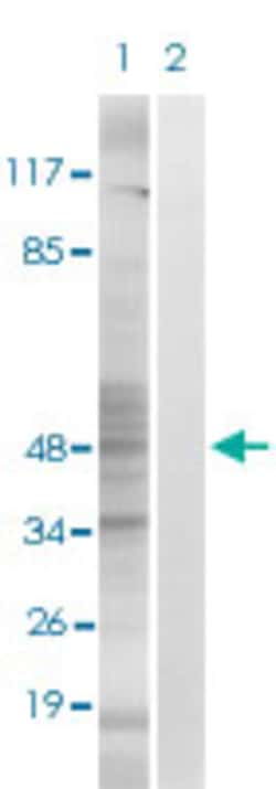 MAPKAPK2 (phospho S272) Rabbit anti-Human, Mouse, Rabbit, Polyclonal ,
