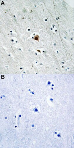 MAPKAPK2 (phospho S272) Rabbit anti-Human, Mouse, Rabbit, Polyclonal ,