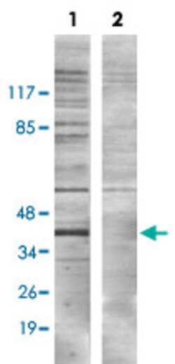 KCNJ11 (phospho T224) Rabbit anti-Human, Mouse, Polyclonal , Abnova 100 &mu;L | Buy Online | Abnova | Fisher Scientific