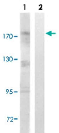 TOP2A (phospho S1106) Rabbit anti-Human, Mouse, Polyclonal , Abnova 100&mu;L;