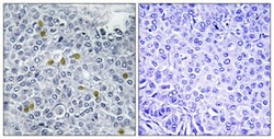 TOP2A (phospho S1106) Rabbit anti-Human, Mouse, Polyclonal , Abnova 100&mu;L;