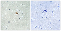 NTRK1 (phospho Y701) Rabbit anti-Human, Mouse, Rat, Polyclonal , Abnova 100 &mu;L | Buy Online | Abnova Corporation | Fisher Scientific