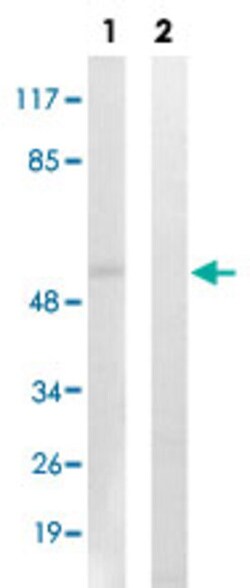 AKT1/AKT3 (phospho Y437) Rabbit anti-Human, Mouse, Rat, Polyclonal , Abnova 100 &mu;L | Buy Online | Abnova | Fisher Scientific