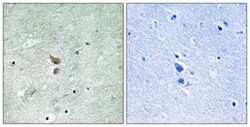RIPK2 (phospho S176) Rabbit anti-Human, Mouse, Polyclonal , Abnova 100&mu;L;