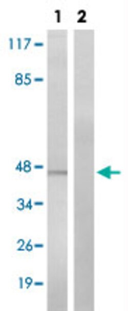 RARA (phospho S77) Rabbit anti-Human, Mouse, Rat, Polyclonal , Abnova 100&mu;L;
