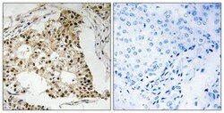 RARA (phospho S77) Rabbit anti-Human, Mouse, Rat, Polyclonal , Abnova 100&mu;L;
