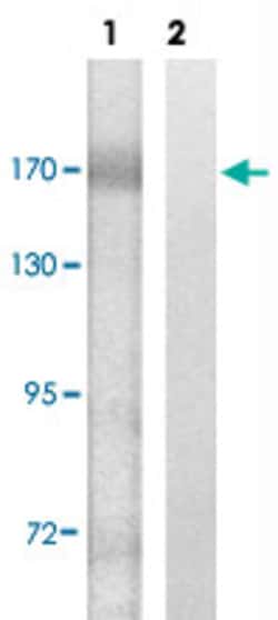 ALK (phospho Y1604) Rabbit anti-Human, Polyclonal , Abnova 100&mu;L; Unlabeled:Antibodies,
