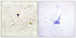 ALK (phospho Y1604) Rabbit anti-Human, Polyclonal , Abnova 100&mu;L; Unlabeled:Antibodies,
