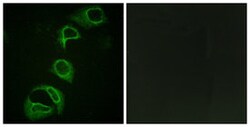 ALK (phospho Y1604) Rabbit anti-Human, Polyclonal , Abnova 100&mu;L; Unlabeled:Antibodies,