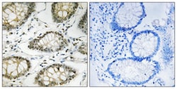 ATR (phospho S428) Rabbit anti-Human, Polyclonal , Abnova 100&mu;L; Unlabeled:Antibodies,
