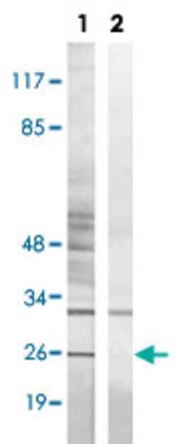 BIK (phospho T33) Rabbit anti-Human, Polyclonal , Abnova 100 &mu;L | Buy Online | Abnova | Fisher Scientific