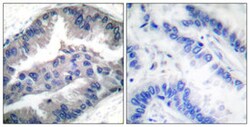 BIK (phospho T33) Rabbit anti-Human, Polyclonal , Abnova 100 &mu;L | Buy Online | Abnova | Fisher Scientific