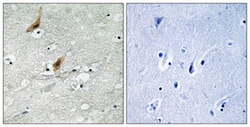 RPS6KA4 (phospho T568) Rabbit anti-Human, Mouse, Polyclonal , Abnova 100&mu;L;
