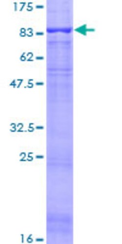 Abnova Human ACCN2 Full-length ORF (NP_001086.2, 1 a.a. - 528 a.a.) Recombinant Protein with GST-tag at N-terminal 25 &mu;g | Buy Online | Abnova&trade; | Fisher Scientific