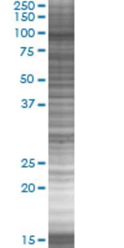 Abnova&trade;&nbsp;ACTN1 293T Cell Transient Overexpression Lysate (Denatured)
