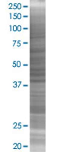 Abnova ADH7 293T Cell Transient Overexpression Lysate (Denatured) (T02) 100 &mu;L | Buy Online | Abnova&trade; | Fisher Scientific