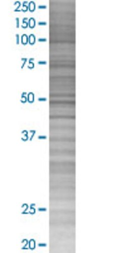 Abnova&trade;&nbsp;ADRB2 293T Cell Transient Overexpression Lysate (Denatured) (T02)