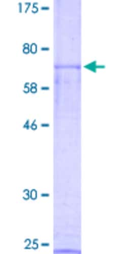 Abnova Human NR0B1 Full-length ORF (NP_000466.2, 1 a.a. - 470 a.a.) Recombinant Protein with GST-tag at N-terminal 2 &mu;g | Buy Online | Abnova&trade; | Fisher Scientific