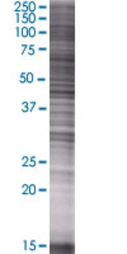 Abnova ALDH3B1 293T Cell Transient Overexpression Lysate (Denatured) 100 &mu;L | Buy Online | Abnova&trade; | Fisher Scientific