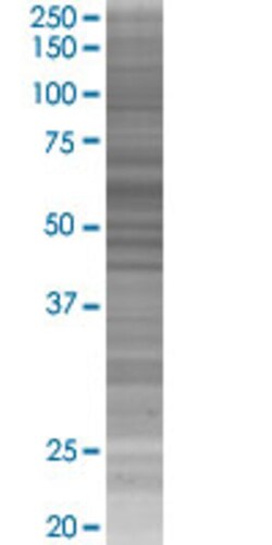 Abnova ARCN1 293T Cell Transient Overexpression Lysate (Denatured) (T02) 100&mu;L | Buy Online | Abnova&trade; | Fisher Scientific