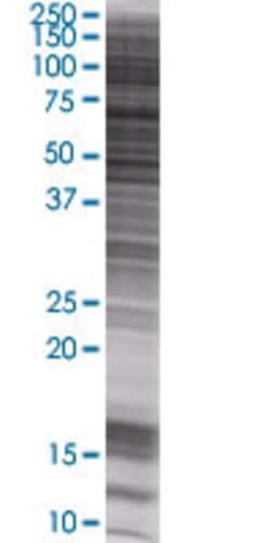 Abnova ATP4B 293T Cell Transient Overexpression Lysate (Denatured) (T02) 100 &mu;L | Buy Online | Abnova&trade; | Fisher Scientific