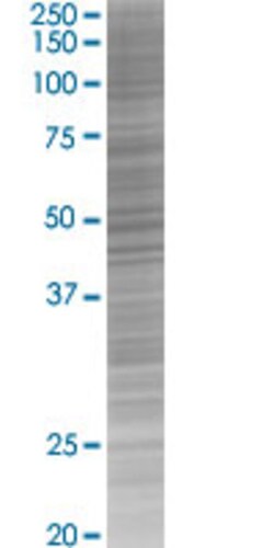 Abnova ATP6V1C1 293T Cell Transient Overexpression Lysate (Denatured) 100 &mu;L | Buy Online | Abnova&trade; | Fisher Scientific