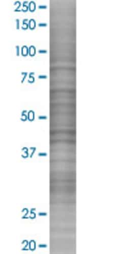 Abnova AZGP1 293T Cell Transient Overexpression Lysate (Denatured) 100 &mu;L | Buy Online | Abnova&trade; | Fisher Scientific